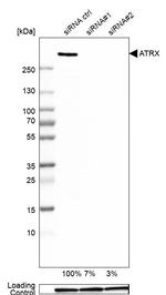 ATRX Antibody in Western Blot (WB)