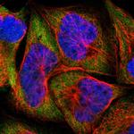 FARSA Antibody in Immunocytochemistry (ICC/IF)