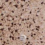 FARSA Antibody in Immunohistochemistry (Paraffin) (IHC (P))