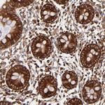 FARSA Antibody in Immunohistochemistry (Paraffin) (IHC (P))