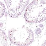 NFE2 Antibody in Immunohistochemistry (IHC)