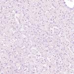 NFE2 Antibody in Immunohistochemistry (IHC)