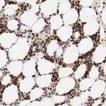 NFE2 Antibody in Immunohistochemistry (IHC)