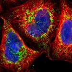 TOP1MT Antibody in Immunocytochemistry (ICC/IF)