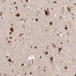 TOP1MT Antibody in Immunohistochemistry (Paraffin) (IHC (P))