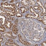 ERLIN2 Antibody in Immunohistochemistry (Paraffin) (IHC (P))