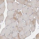 ERLIN2 Antibody in Immunohistochemistry (Paraffin) (IHC (P))