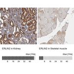 ERLIN2 Antibody in Immunohistochemistry (IHC)