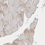 ERLIN2 Antibody in Immunohistochemistry (IHC)