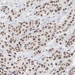 MBD4 Antibody in Immunohistochemistry (IHC)