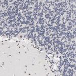 MBD4 Antibody in Immunohistochemistry (IHC)