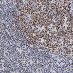 MBD4 Antibody in Immunohistochemistry (IHC)