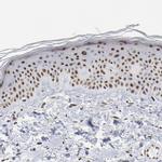 MBD4 Antibody in Immunohistochemistry (IHC)