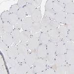 IGF2BP3 Antibody in Immunohistochemistry (IHC)