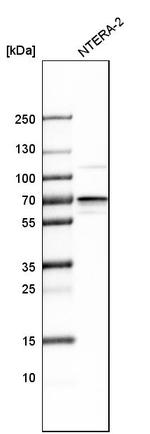 IGF2BP3 Antibody in Western Blot (WB)