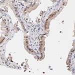 PSMC4 Antibody in Immunohistochemistry (Paraffin) (IHC (P))