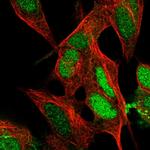 ARHGAP36 Antibody in Immunocytochemistry (ICC/IF)