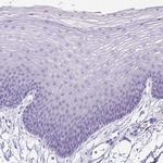 ARHGAP36 Antibody in Immunohistochemistry (Paraffin) (IHC (P))