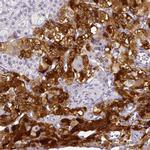 ARHGAP36 Antibody in Immunohistochemistry (IHC)