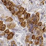 ARHGAP36 Antibody in Immunohistochemistry (IHC)