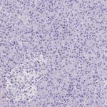 ARHGAP36 Antibody in Immunohistochemistry (IHC)