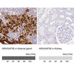 ARHGAP36 Antibody