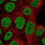 TCF2 Antibody in Immunocytochemistry (ICC/IF)