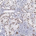 TCF2 Antibody in Immunohistochemistry (IHC)