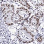 TCF2 Antibody in Immunohistochemistry (IHC)