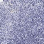 TCF2 Antibody in Immunohistochemistry (IHC)