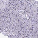 SULT1B1 Antibody in Immunohistochemistry (Paraffin) (IHC (P))