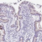 SULT1B1 Antibody in Immunohistochemistry (Paraffin) (IHC (P))