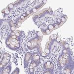 SULT1B1 Antibody in Immunohistochemistry (IHC)