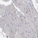 KDM6A Antibody in Immunohistochemistry (Paraffin) (IHC (P))