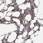 KDM6A Antibody in Immunohistochemistry (IHC)