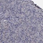 KDM6A Antibody in Immunohistochemistry (IHC)