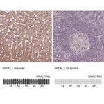 HYAL1 Antibody in Immunohistochemistry (IHC)