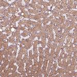 HYAL1 Antibody in Immunohistochemistry (IHC)