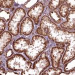 HYAL1 Antibody in Immunohistochemistry (IHC)