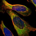 PFKM Antibody in Immunocytochemistry (ICC/IF)