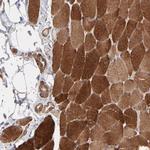 PFKM Antibody in Immunohistochemistry (Paraffin) (IHC (P))