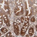 GART Antibody in Immunohistochemistry (Paraffin) (IHC (P))