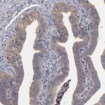 FAM62B Antibody in Immunohistochemistry (IHC)