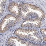 FAM62B Antibody in Immunohistochemistry (IHC)