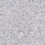 FAM62B Antibody in Immunohistochemistry (IHC)