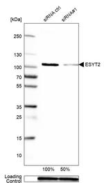 FAM62B Antibody in Western Blot (WB)