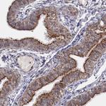 LONP1 Antibody in Immunohistochemistry (IHC)