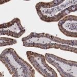 LONP1 Antibody in Immunohistochemistry (IHC)