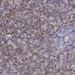 LONP1 Antibody in Immunohistochemistry (IHC)