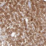 Aldolase B Antibody in Immunohistochemistry (IHC)